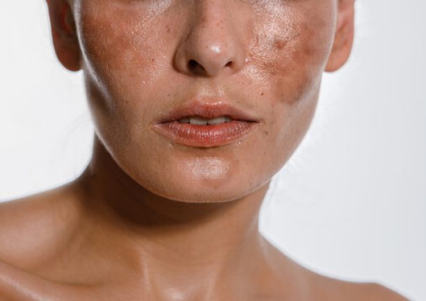 360_F_513036292_bmAZZ2JgmehusgNVvfDf5GbPVmFqjBCR 360_F_513036292_bmAZZ2JgmehusgNVvfDf5GbPVmFqjBCR