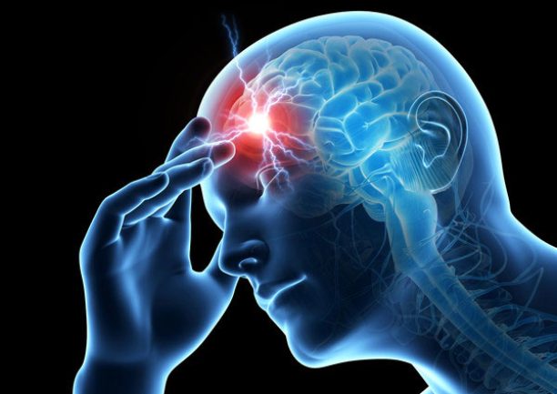 Migraine-Headache Migraine-Headache