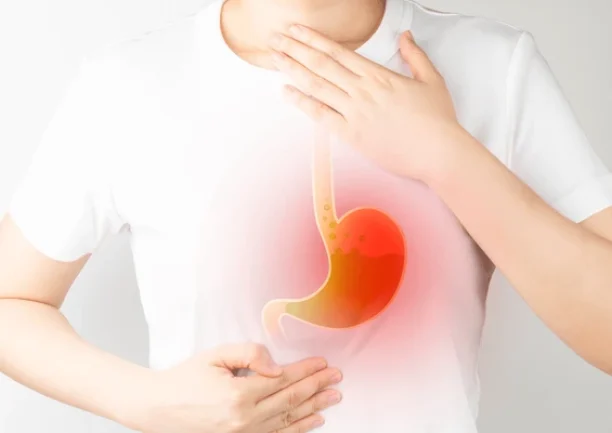 gastroesophageal-reflux-disease-gerd-acid-600nw-1994470688 gastroesophageal-reflux-disease-gerd-acid-600nw-1994470688