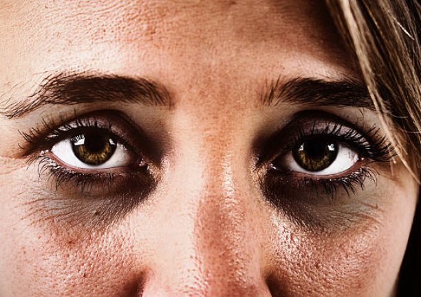 istockphoto-527033884-612×612 Cropped close up of a woman's sad, exhausted brown eyes, ringed with dark circles and looking straight at the camera.